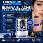 Edición Limitada UltraBrush™ - La solución definitiva para el acné e imperfecciones de tu rostro